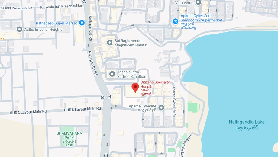 Location of Lathik Villas in Tellapur, Hyderabad - Image 392511