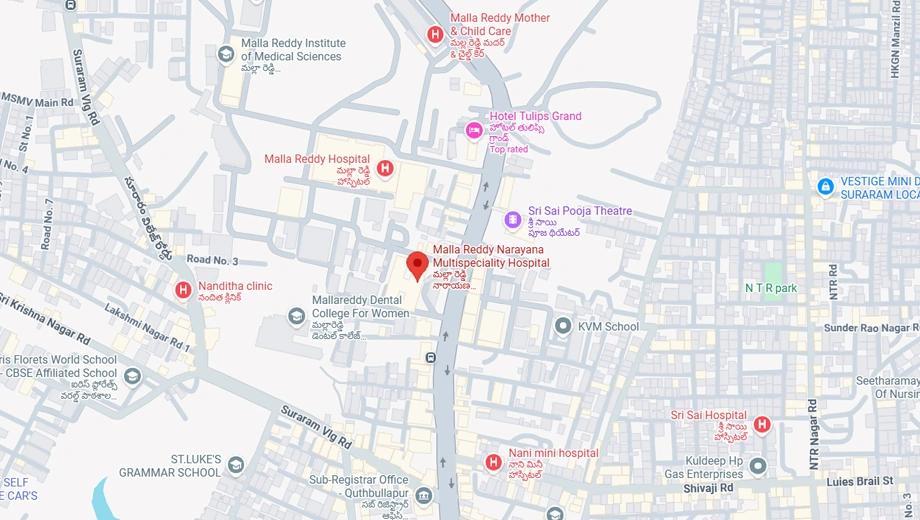 Location of Vista Supra Villas in Tellapur, Hyderabad - Image 393534